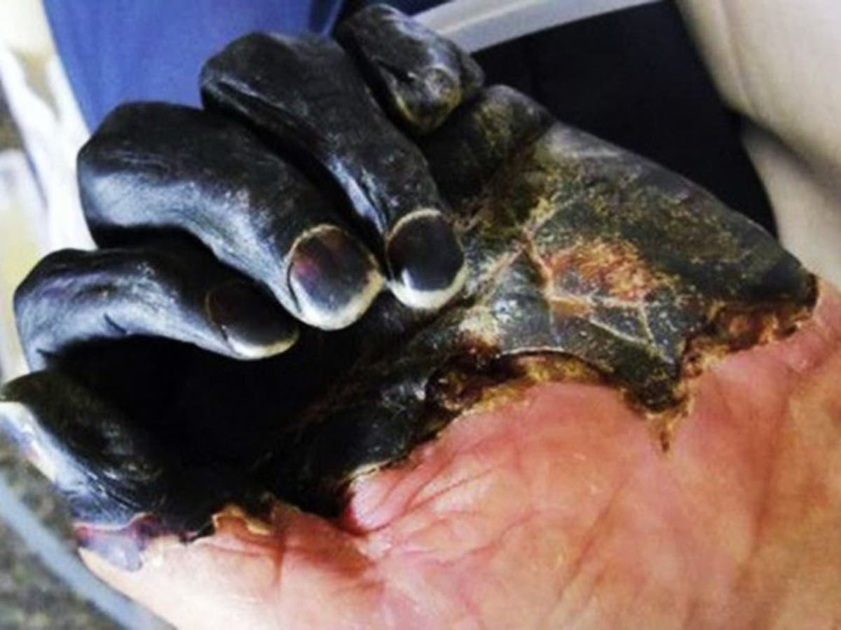 California reporta primer caso de peste bubónica en las últimas horas california-reporta-primer-caso-de-peste-bubonica-en-las-ultimas-horas